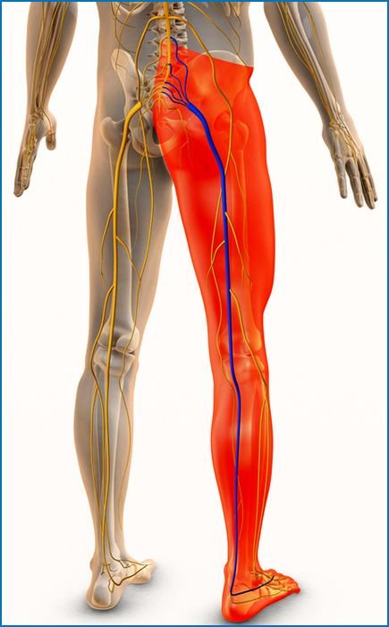 “Sciatica Pain Physiotherapy in Gurugram
